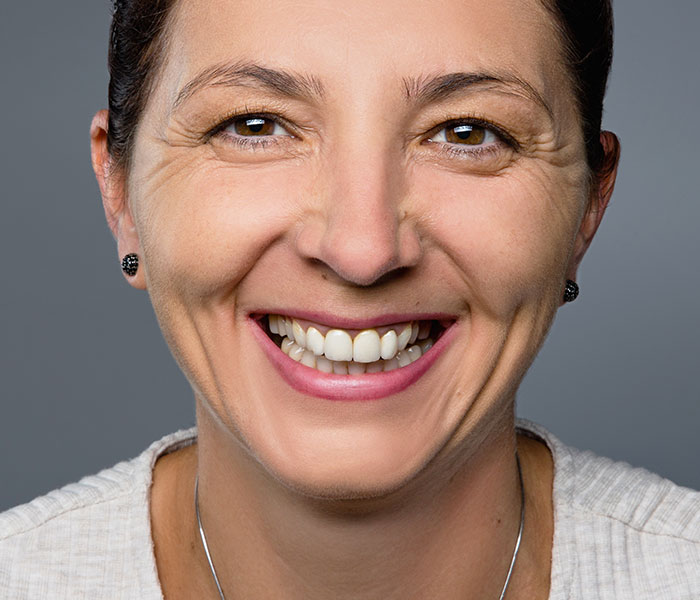Vorher